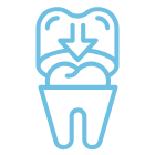 Prótesis Dentales