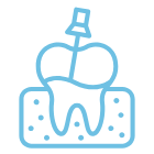Endodoncia